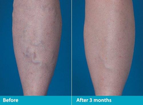 Beach Cities Vein and Laser Center image