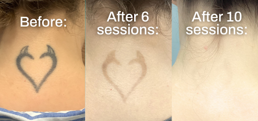 Explore cute tattoo ideas for females, creative tattoo ideas in Round Rock, available at Removery Tattoo Removal & Fading