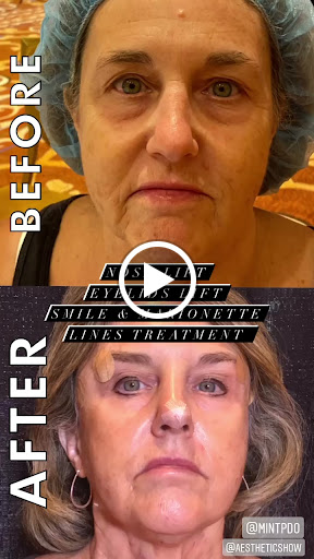 Explore racing tattoo ideas, creative tattoo ideas in Lake Oswego, available at Lake Oswego Vein and Aesthetic LOVA