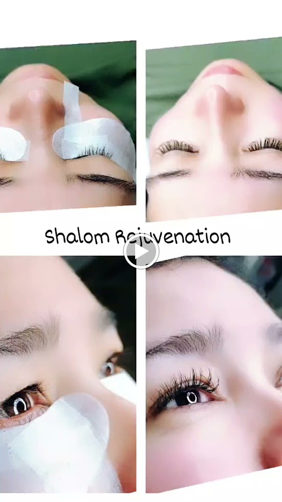 Shalom Rejuvenation 27858