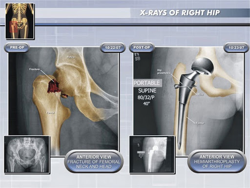 Personal Injury Attorney «Law Offices of James O. Cunningham, P.A.», reviews and photos