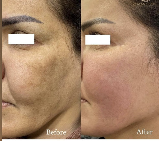 Medical Spa «Lavender Med Spa», reviews and photos, 3675 Crestwood Pkwy #400, Duluth, GA 30096, USA