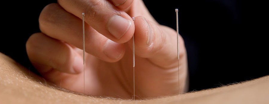 Reading Acupuncture Clinic