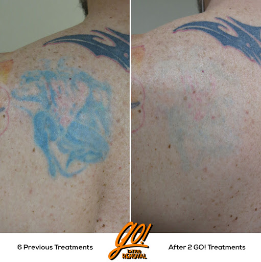 Explore baseball tattoos ideas, creative tattoo ideas in Allentown, available at Removery Tattoo Removal & Fading