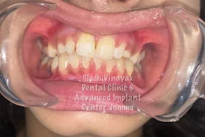 SIDDHIVINAYAK DENTAL CLINIC & ADVANCE IMPLANT CENTRE, Dr Sourav Malhotra(MDS), Dr Aditi Nagpal (MDS) Endodontist image