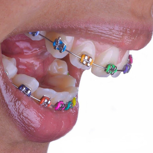 Opinii despre Go - Dental în <nil> - Dentist