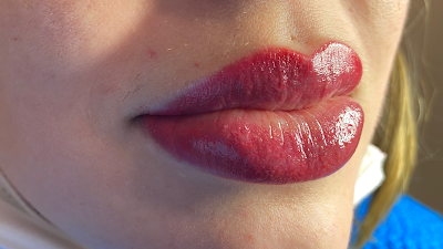 BeautyLips à Pont-à-Mousson