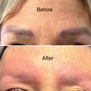 Explore tequila tattoo ideas, creative tattoo ideas in Latrobe, available at Laser180