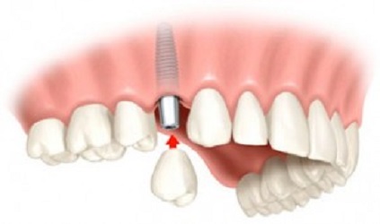 Opinii despre Dr. Finkel Dental Clinic în <nil> - Dentist