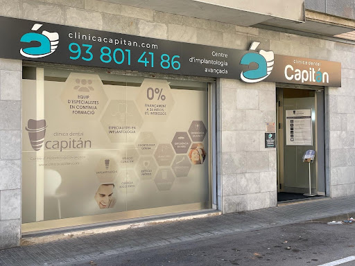 Sonde Parodontali CP12 Misurazione Tasca Dentale Marcatura Con Codice