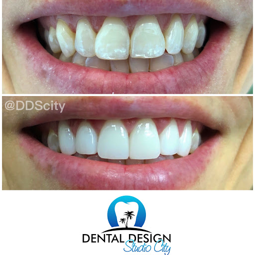 Dental Design Studio City image