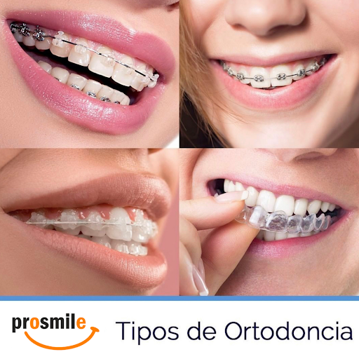 Prosmile (Dentist - Odontólogos - Dentistas en cordoba - Implantes Dentales )