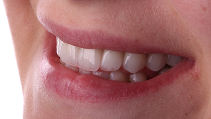 Diş Hekimi Zahid Ak - Konya Estetik Diş Hekimi, Dijital, Gülüş Tasarımı, Özel, İmplant, Zirkonyum, Diş Estetiği, Tavsiye
