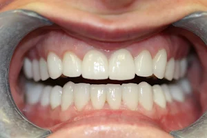 Rejuvenation Dentistry image