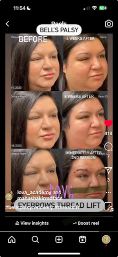 Explore club america tattoo ideas, creative tattoo ideas in Lake Oswego, available at Lake Oswego Vein and Aesthetic LOVA