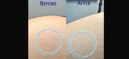 Explore aladdin tattoo ideas, creative tattoo ideas in Victorville, available at Goawaytats tattoo removal