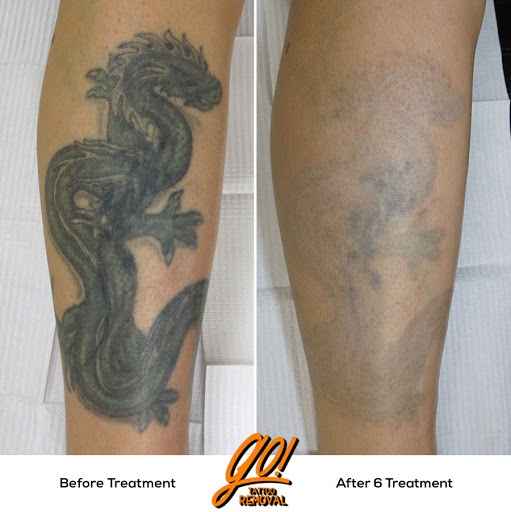 Explore leg tattoo ideas small, creative tattoo ideas in Allentown, available at Removery Tattoo Removal & Fading