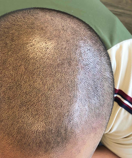 SMP Hair Clinic The Queen Of Scalp image
