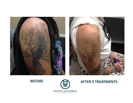 Explore hurricane tattoo ideas, creative tattoo ideas in San Diego, available at Removery Tattoo Removal & Fading