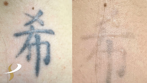 Explore arm butterfly tattoo ideas, creative tattoo ideas in Spokane, available at Premier Body and Laser