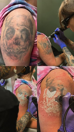 Explore sleeve skull tattoo ideas, creative tattoo ideas in Naperville, available at Reverse Hex Tattoo Removal