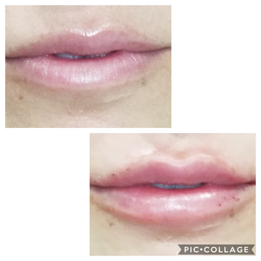 Medical Spa «New Image Medical Spa», reviews and photos, 680 Mowry Ave, Fremont, CA 94536, USA