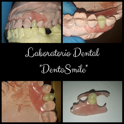 Laboratorio Dental Dentosmile - Laboratorio