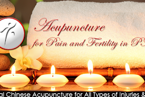 Acupuncture for Pain & Infertility image