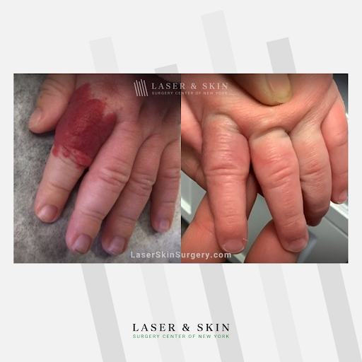 Explore tattoo ideas for parents, creative tattoo ideas in New York, available at Laser & Skin Surgery Center