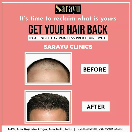 Sarayu Best Hair Transplant Clinic in Delhi | Best Skin Treatment in Delhi | Face Enhancement | Wrinkle Treatment in Delhi | Botox and Fillers in Delhi