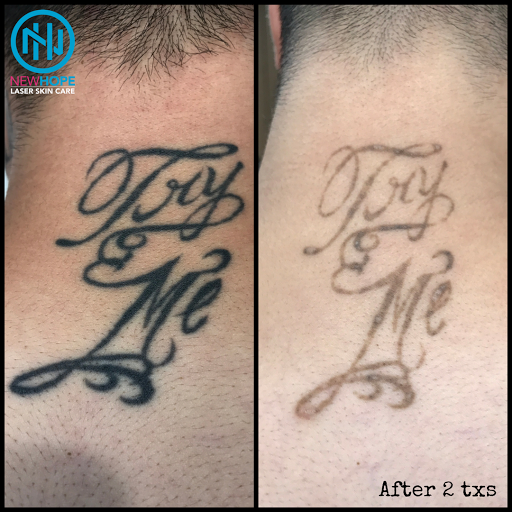 Explore golden retriever tattoo ideas, creative tattoo ideas in Westminster, available at Newhope Laser Skin Care