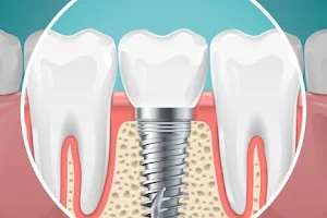 Dhingra Dental Care image