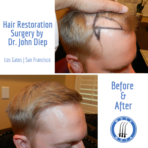 Medical Hair Transplant & Aesthetics