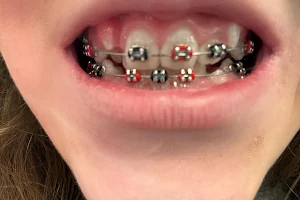Plaistow Pediatric Dentistry & Orthodontics image