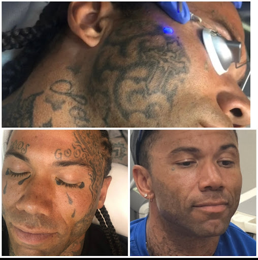 Find breast tattoo ideas for females for your next unique tattoo in Tucson at Allure Medical