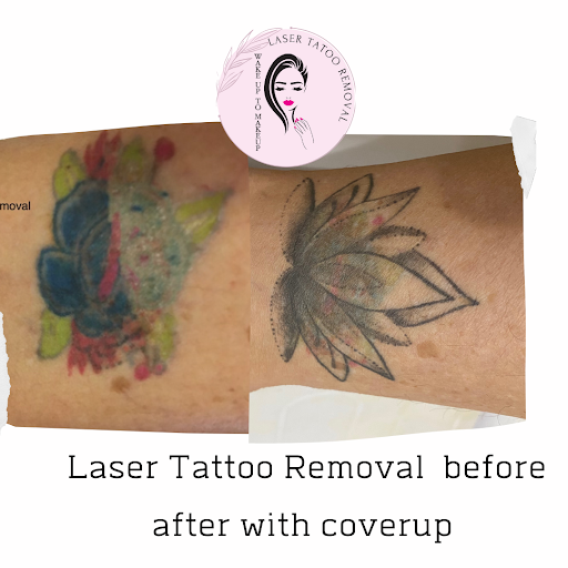 Explore puzzle piece tattoo ideas, creative tattoo ideas in Naples, available at Laser Tattoo Removal Services