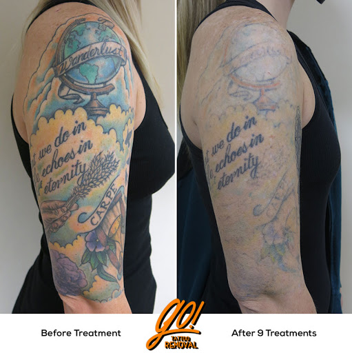 Find joker tattoo ideas for men for your next unique tattoo in Allentown at Removery Tattoo Removal & Fading