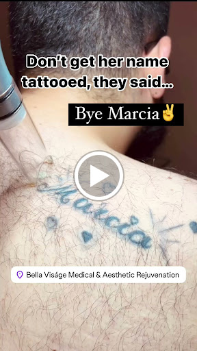 Explore fallout 4 tattoo ideas, creative tattoo ideas in Lakeland, available at Bella Visge Medical & Aesthetic Rejuvenation