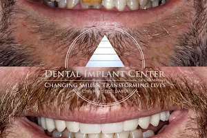 Dental Implant Center of Oklahoma | Chris Ward DDS DABOI image