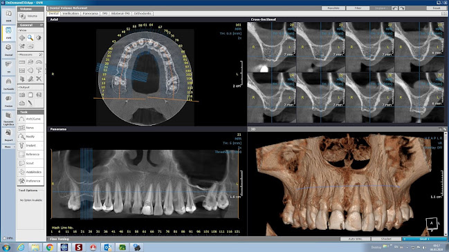 Dental X Rad - Radiologie si Tomografie Dentara Targoviste - Dentist