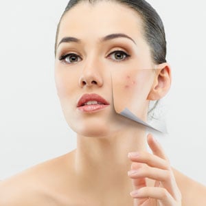 Skin cleaning Miami
