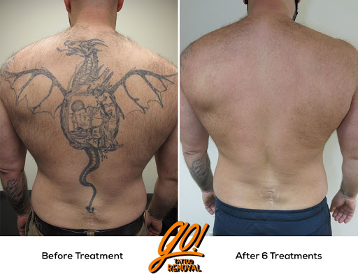 Explore elbow tattoo ideas male, creative tattoo ideas in Allentown, available at Removery Tattoo Removal & Fading