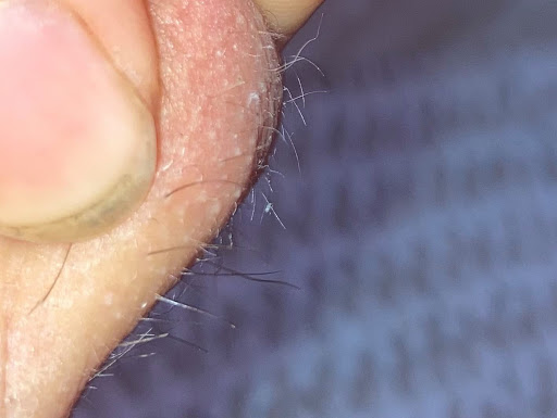 Hair Removal Service «Aesthetics by Karen Marlise DBA Tampa Bay Laser Hair Removal», reviews and photos, 10701 Village Green Ave, Seminole, FL 33772, USA