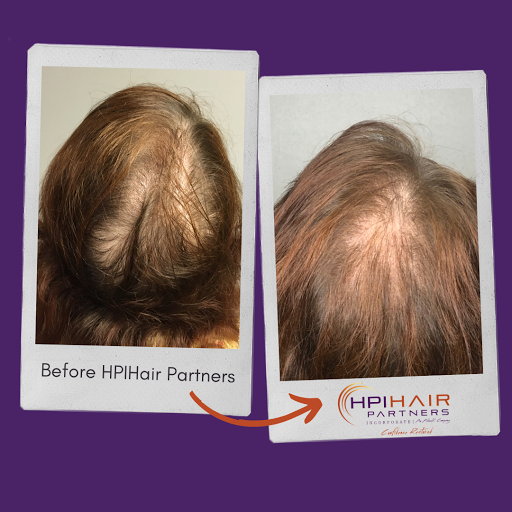 Hair Replacement Service «HPI Hair Partners», reviews and photos, 4535 Harding Pike #302, Nashville, TN 37205, USA