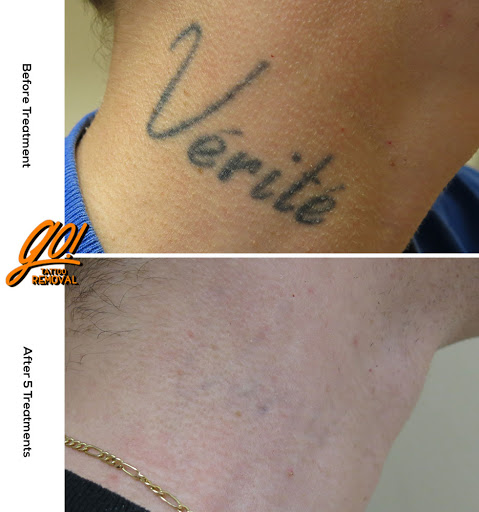 Explore tattoo shading ideas filler, creative tattoo ideas in Allentown, available at Removery Tattoo Removal & Fading