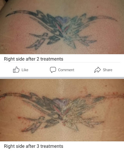 Find gothic tattoo ideas for women for your next unique tattoo in Idaho Falls at Senza Skin Spa Senza Weight Loss