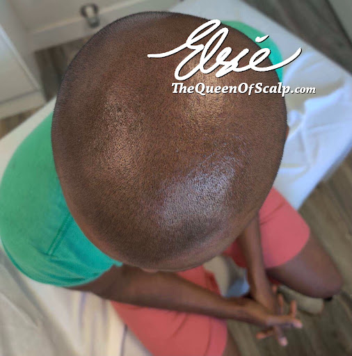 SMP Hair Clinic The Queen Of Scalp image