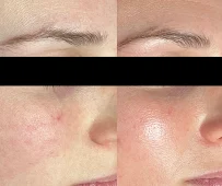 Moon Face Aesthetics - Car repair in Dayton, OH, Dayton - Rated 5.0/5