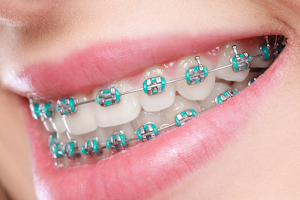 Gamma Dental image