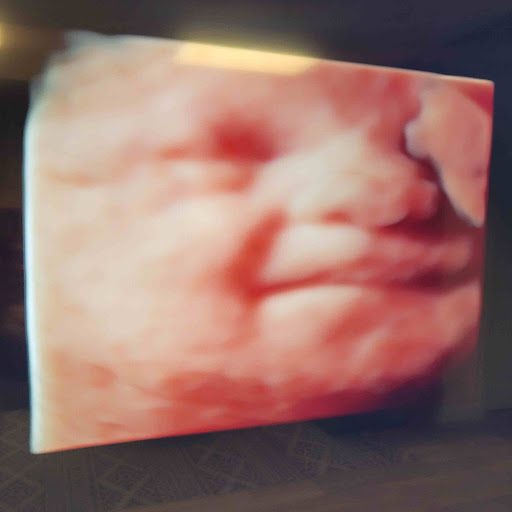 Baby Wave 4D Ultrasound image